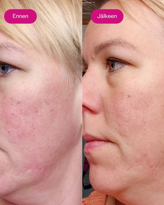 AHA & BHA PEELING SERUM kuoriva ja kirkastava yöseerumi 30 ml