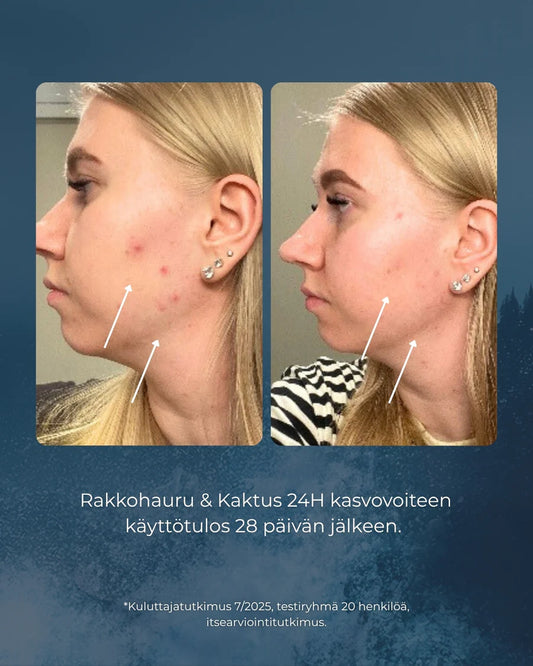 RAKKOHAURU KASVOSETTI - Anti-age seerumi & 24h voide