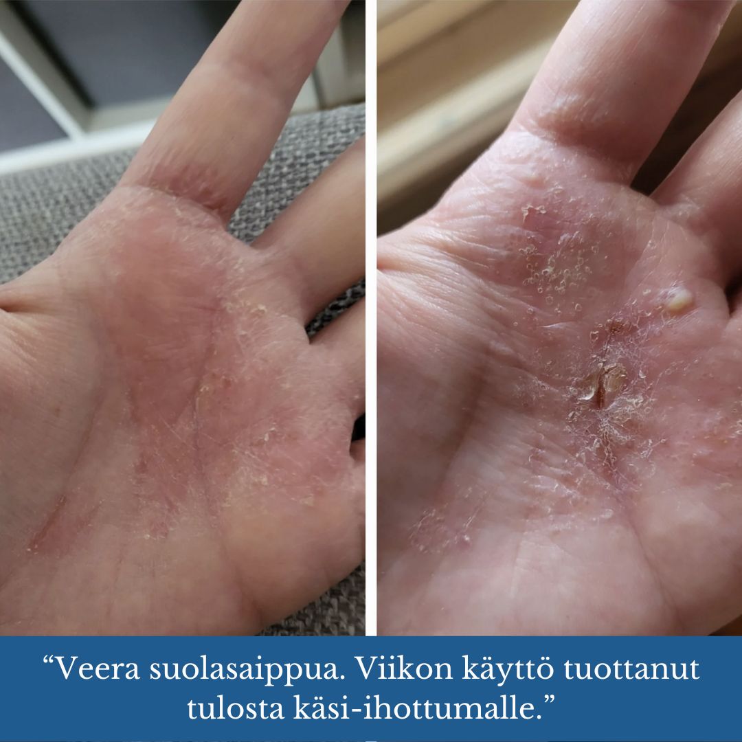 VEERA SUOLASAIPPUA® 100 gr